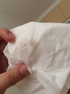浅褐色,浅褐色分泌物是怎么回事？