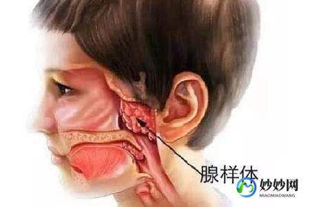 腺样体容貌,腺样体肥大外貌是什么症状