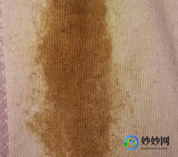 浅褐色,白带呈浅褐色怎么回事