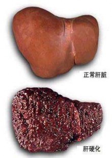 茄化是什么意思,肝灶化是什么意思