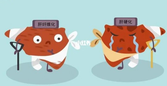 茄化是什么意思,肝灶化是什么意思