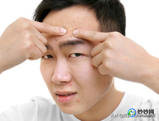 男士去粉刺,青春期的男孩脸上有很多粉刺怎么办