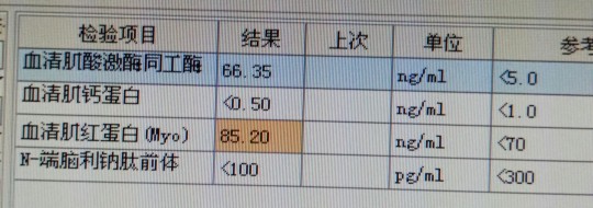 心肌酶高是什么意思,心肌酶高是什么原因