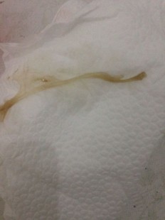 阴里区为什么会流出来像棕色物体,下面流棕色的粘稠液体