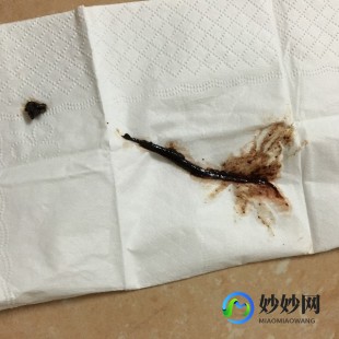 阴里区为什么会流出来像棕色物体,下面流棕色的粘稠液体