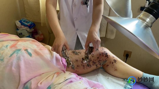 女性外部生殖图示的结构详解,外阴结构图