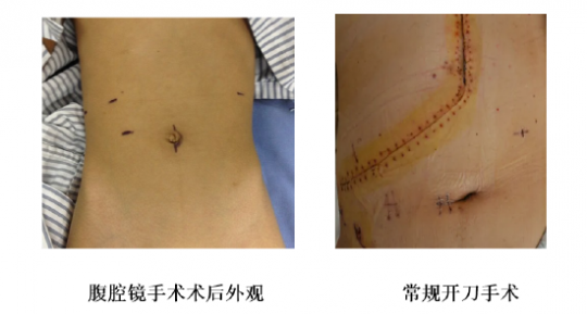 胆道闭锁,胆道闭锁有什么症状