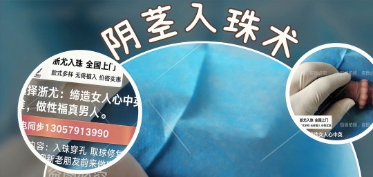 男性入珠,男性植入珍珠是干吗