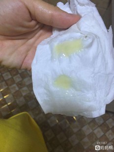 男生下面流出来透明粘稠物是,男生透明粘稠分泌物会怀孕吗