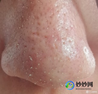 鬼头有小白点,有白色米粒点