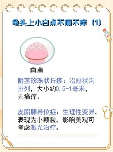 鬼头有小白点,有白色米粒点