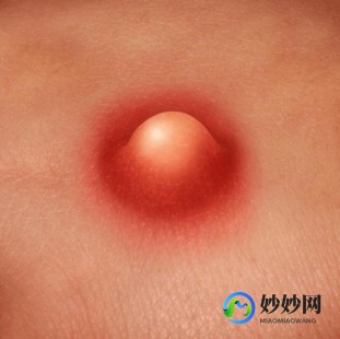 阴脣上长疙瘩什么原因,上长小疙瘩是怎么回事
