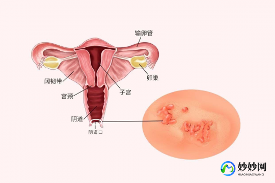 阴掰开有小肉,阴口长了一坨肉一样的是什么
