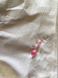 粉红色的液体,有粉色分泌物怎么回事