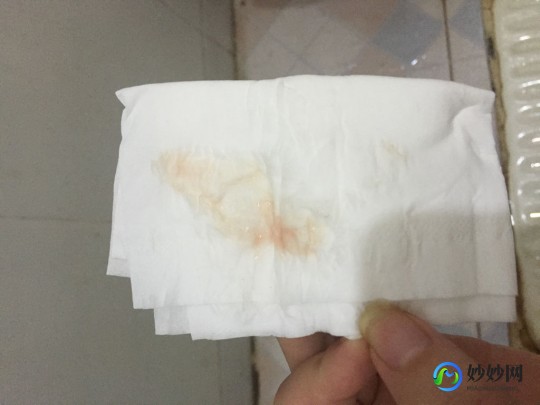 粉红色的液体,有粉色分泌物怎么回事