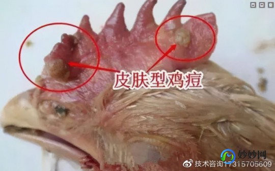 男生的小鸡上长痘痘是怎么回事,上长了好多痘痘