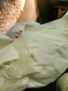 阴里区为什么会流出来透明的东西图,女性下面排出透明胶状的东西