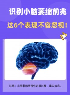 大脑萎缩,大脑小脑都萎缩了是什么症状