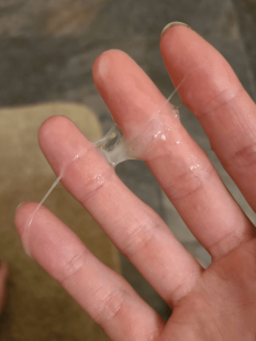 透明液体黏黏男生,男生透明粘稠分泌物会怀孕吗