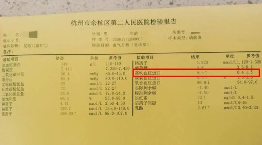 血红蛋白电泳,hb电泳是检查什么内容