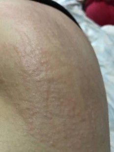 里面痒,里面痒的厉害是怎么回事