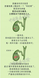 胆囊息肉手术,胆囊息肉怎么切除