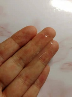 透明液体流出,流透明液体是怎么回事