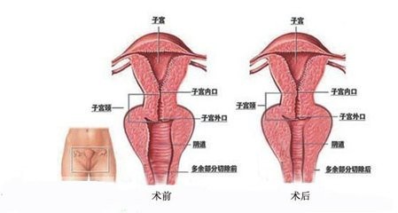 阴紧缩,阴紧是什么原因