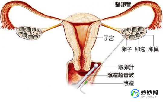 卵巢早衰需要做试管_卵巢早衰需要做试管吗