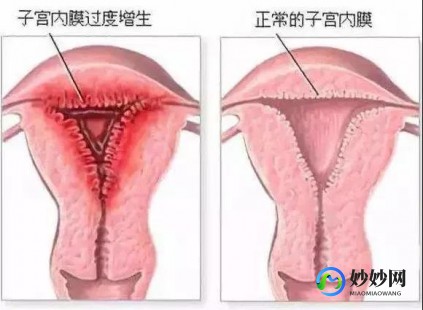 切除一个子宫能生孩吗-切除子宫卵巢能造一个子宫吗