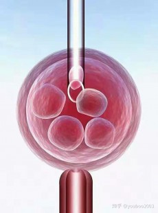 幼稚子宫可以做人工受精;幼稚子宫能做人工授精吗