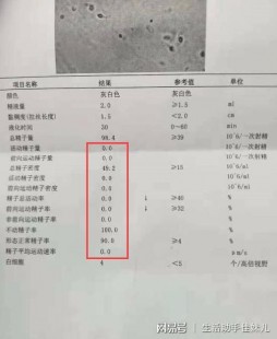 少精弱精怎么做试管_弱精少精症做试管