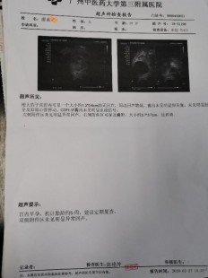 大龄试管调理卵巢早衰(试管卵巢早衰调理药)