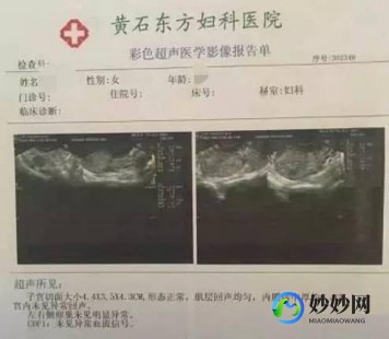 切除子宫8个月后怀孕—子宫肌瘤切除术后的8个月怀孕了
