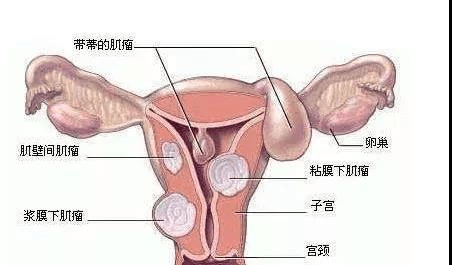 子宫切除一半还能生育嘛子宫切除一半还能生育吗