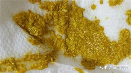 奶粉过浓的大便怎么样 喝了奶粉大便稀怎么办