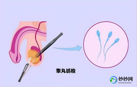 罡丸小无精症试管