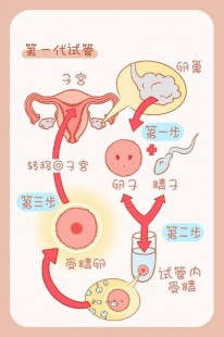 单身生育做几代试管好-35岁单身做试管选择几代