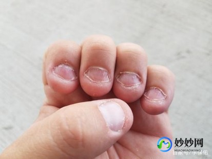 为什么剪指甲不会疼,为什么剪指甲不会痛,揭秘,剪指甲为何无痛感？