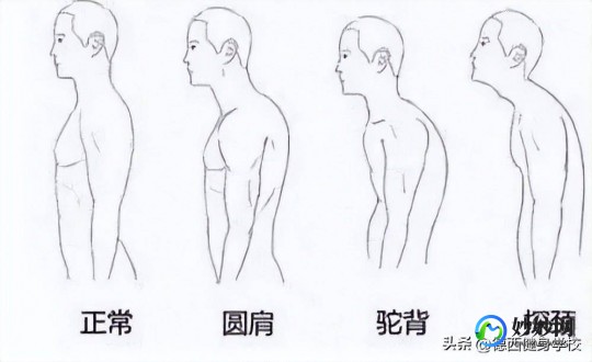 肩膀内扣是什么意思,揭秘肩膀内扣梗背后的真相与改善方法