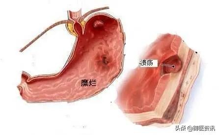 洗一次头P一次,洗一次头拍一次阿司匹林肠溶片可以吗