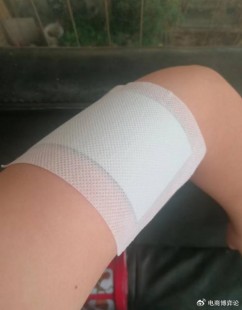 筋膜膏,筋膜膏的功效与作用