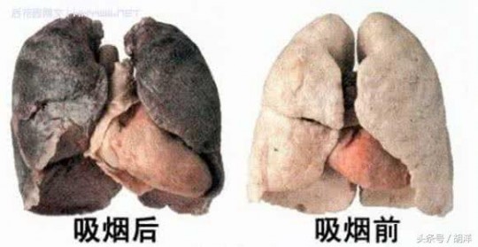 一片红色,身上一片一片红的不痛不痒怎么回事