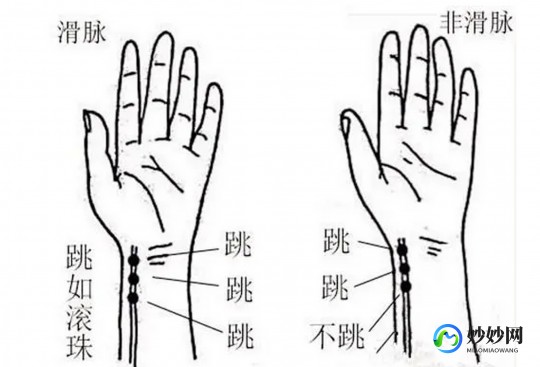 幽脉,幽脉是什么脉