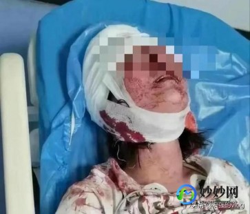 杭州来女士被放血剥皮,杭州遇害女子最新事件,杭州遇害女子最新事件,深度解析与探...