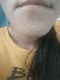 痒痒,口特别痒