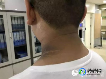 腋下挂什么科室,腋下检查挂什么科