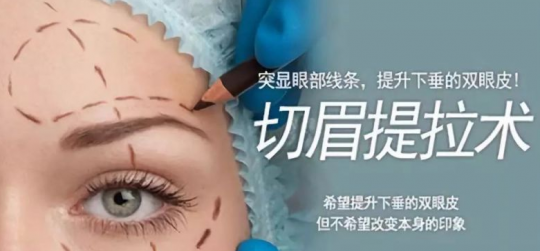 切眉和提眉哪个效果好,切眉和提眉哪个效果好