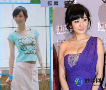 杨幂隆胸多少钱,杨幂隆胸前后对比照片明显尺度变大