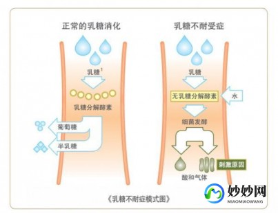 乳糖不耐受奶粉自营新选择：健康与美味兼得